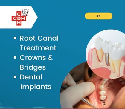 Slider image (3) City Dental - Implant Hospital